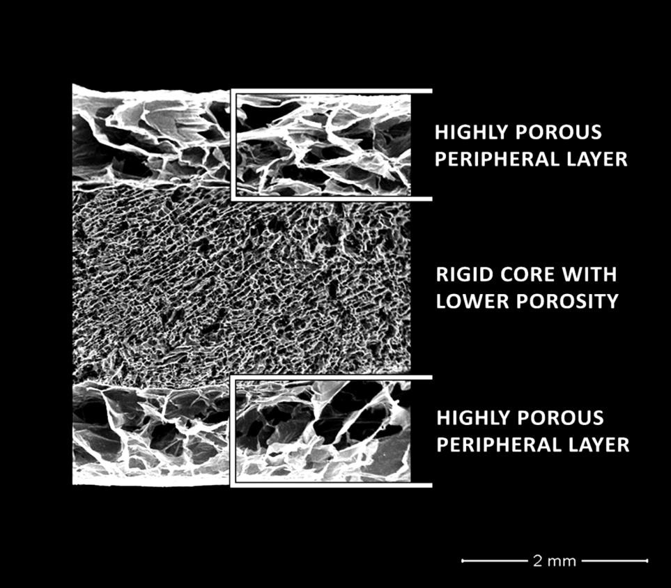 Sandwich and composite collagen sponge