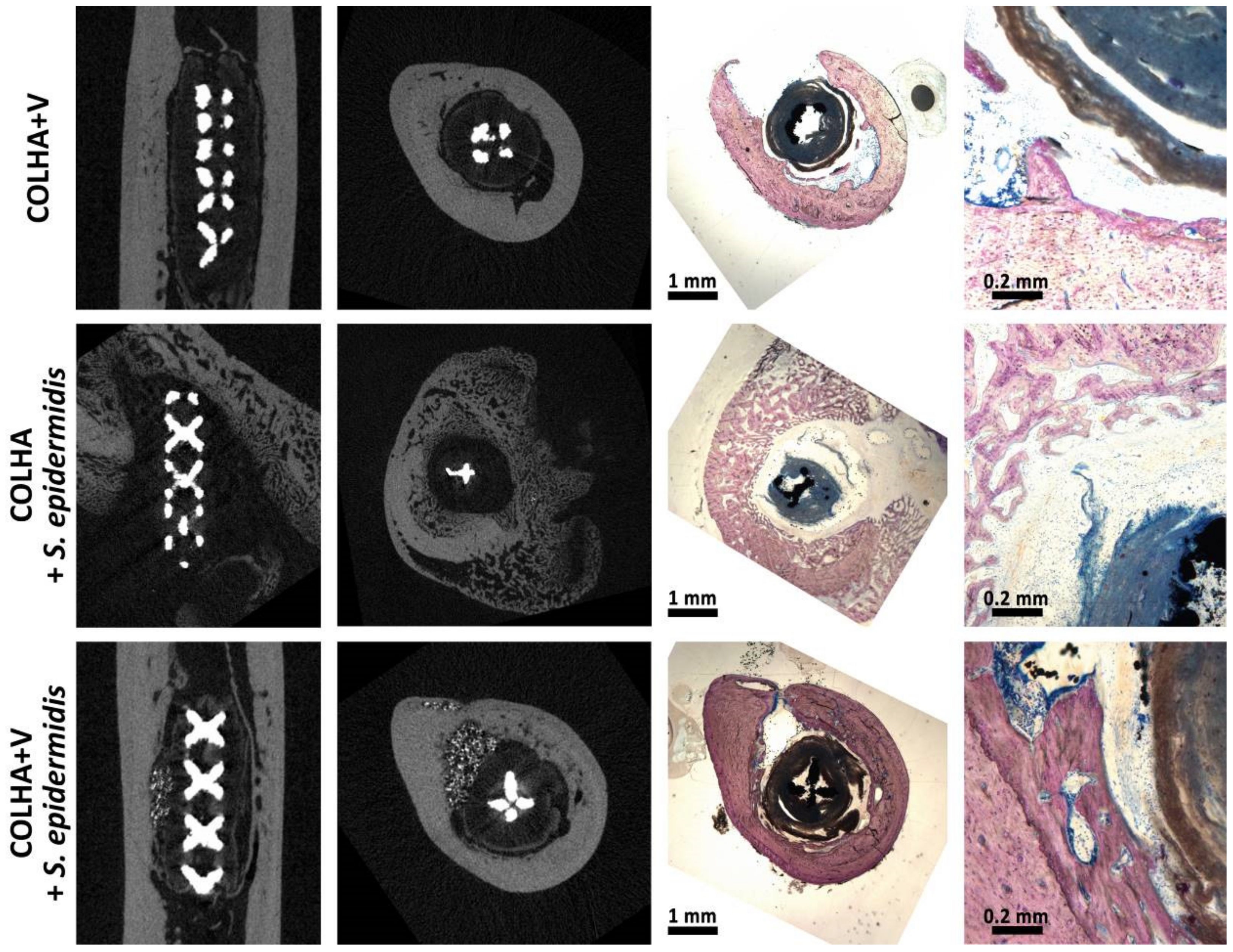 Mikro-CT a histologické snímky identických vzorků v COLHA+V implantáty bez aplikace S. epidermidis (horní linie), implantáty COLHA s S. epidermidis (střední linie) a COLHA+V se skupinami S. epidermidis (spodní linie). 